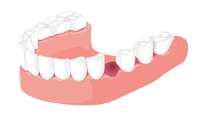 Зуба не було Зуба не було