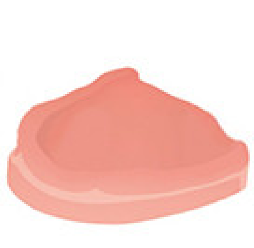 Атрофія кістки Атрофія кістки