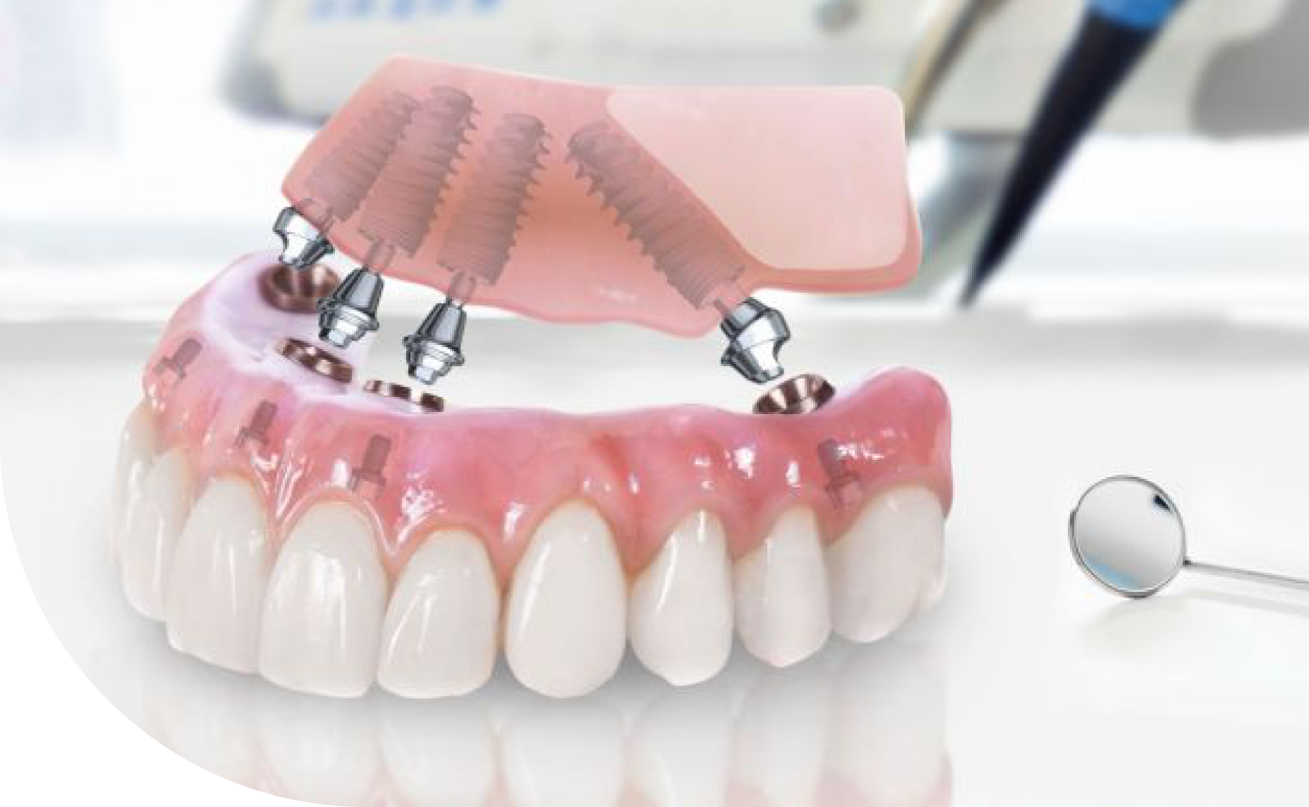 Нові зуби, як свої:   Нові зуби, як свої: