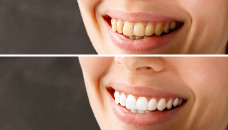 Показання до проведення:  Показання до проведення: