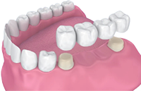 Це найкращий вибір тих, хто боїться стоматологів. Поки Ви відпочиваєте, ми Вас лікуємо.