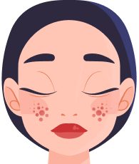 Акне та постакне