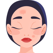 Часта або інтенсивна інсоляція Часта або інтенсивна інсоляція