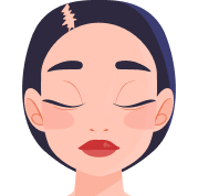 Лікування випадіння волосся, розтяжок і целюліту Лікування випадіння волосся, розтяжок і целюліту