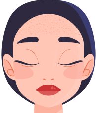 Підвищене потовиділення