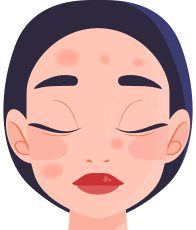 Пігментні плями