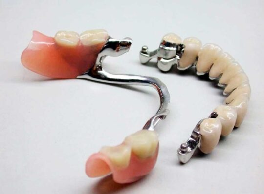 Переваги бюгельних протезів: